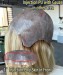 Dolago Best Injection Poly Skin Medical Wigs For Cancer Patients 130% Wholesale Real Virgin Human Hair Medical Wig For Women For Alopecia And Chemo Hair Loss