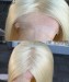 Dolago Luxury Diamond Lace With Silicone Strips Medical Wigs For Cancer Patients 120% Virgin Human Hair Medical Wig For Alopecia And Chemo Hair Loss Wholesale